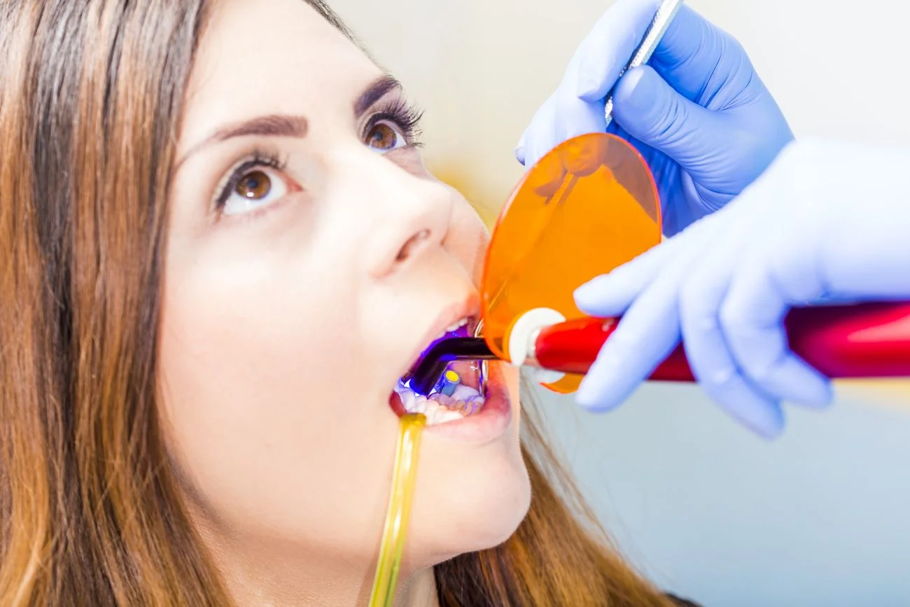 Bonding a licówki – różnice, ceny i zastosowanie